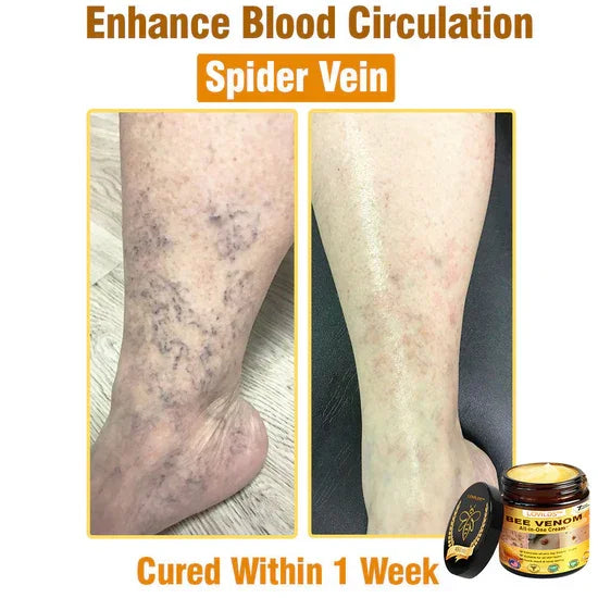 South Moon Bee Venom Pain Relief Cream for Arthritis, Muscle & Joint Discomfort (Original)