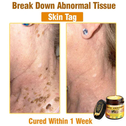 South Moon Bee Venom Pain Relief Cream for Arthritis, Muscle & Joint Discomfort (Original)