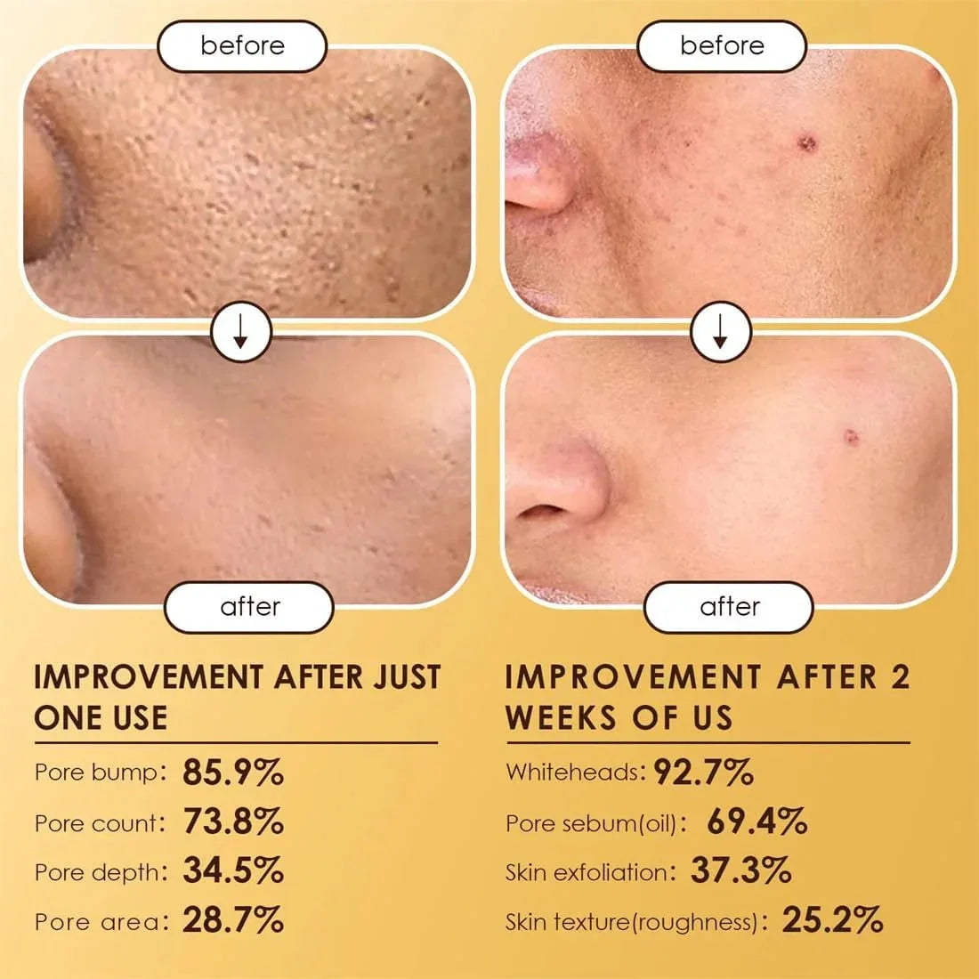Dr Melaxin Peel Shot
